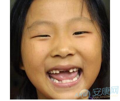 梦见小孩长牙齿有着怎样的好坏预示？(图文)